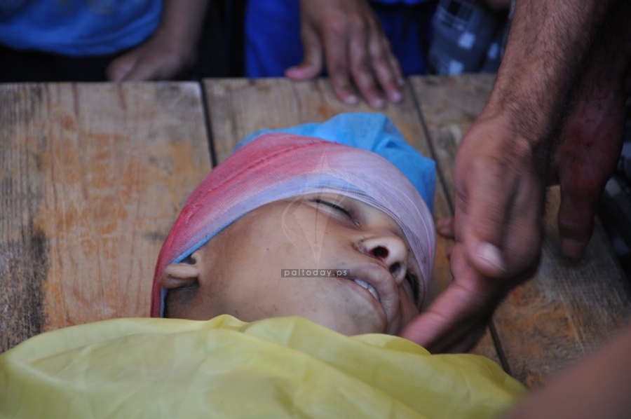 استشهاد طفل فلسطيني متأثراً بجراحه خلال العدوان على قطاع غزة