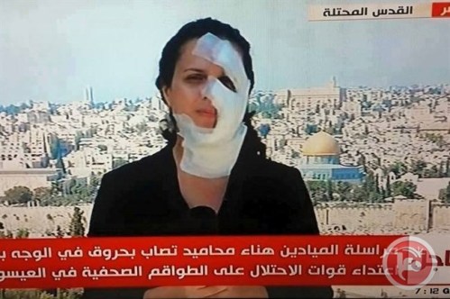 رصاص الاحتلال يطال 30 صحفياً في #فلسطين_المحتلة