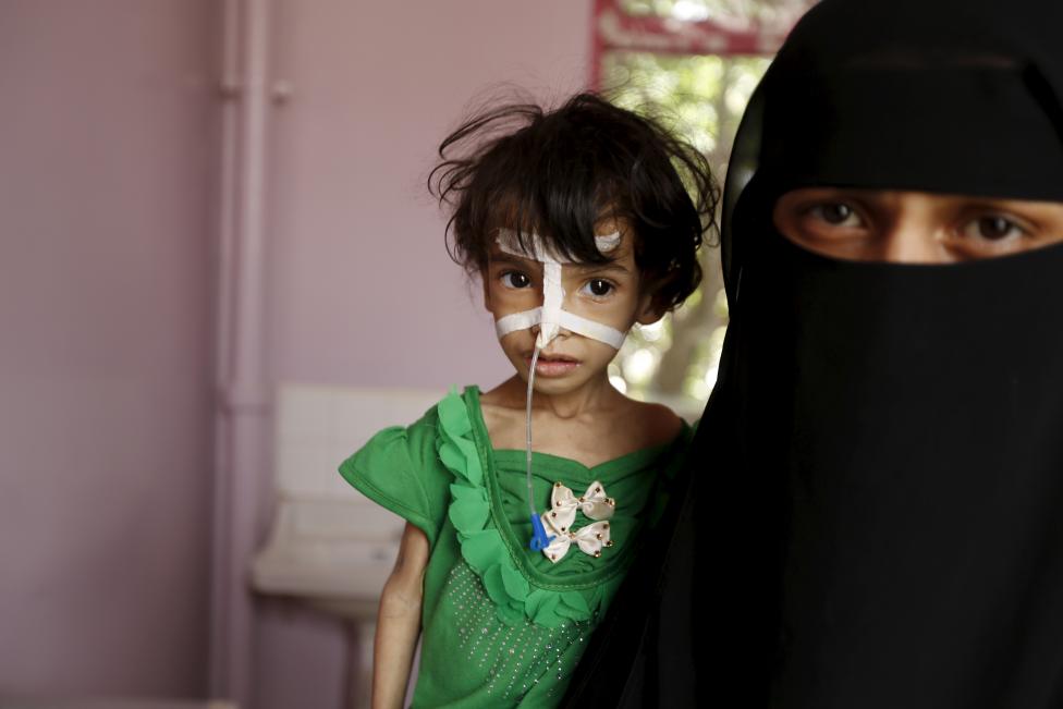 #اليمن: اطفال جوعى يستصرخون ضمير العالم (تقرير مصور)