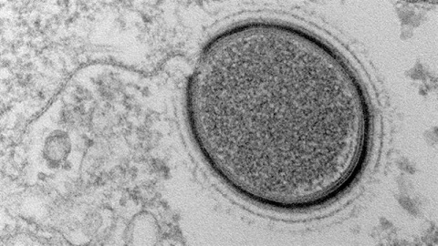 اكتشاف فيروس عمره 30 ألف سنة
