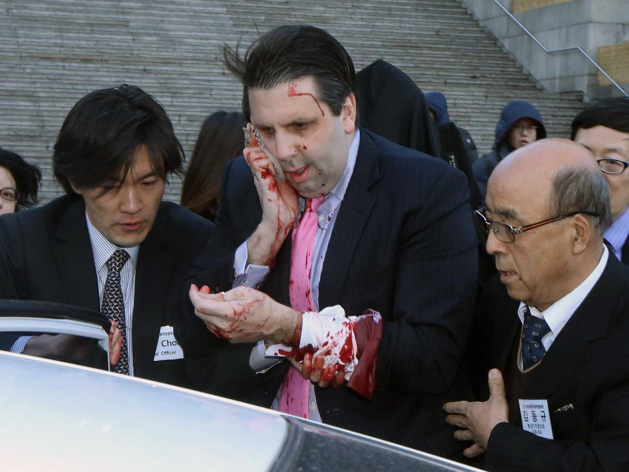 US Ambassador Slashed and Bloodied in Seoul Attack