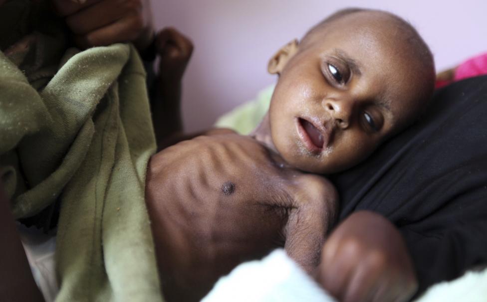 Human Rights Group: Bombs Made in UK Dropped on Yemeni Civilians
