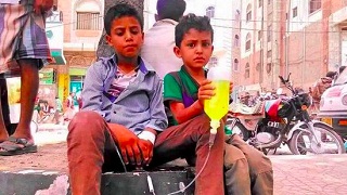 ONU: 850.000 niños sufren de malnutrición por la guerra en Yemen


