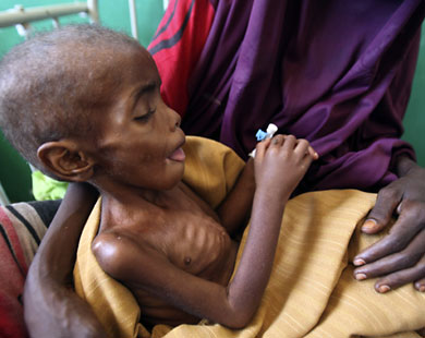 مليون شخص مهددون بالجوع في الصومال والامم المتحدة تحذر من تفاقم الجفاف