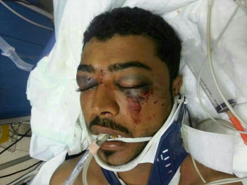 الشرطة البحرينية: انفجار قنبلتين في سار