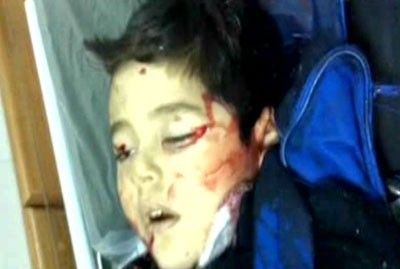 Child Killed, Nine Injured in Syria Kindergarten Bus Attack