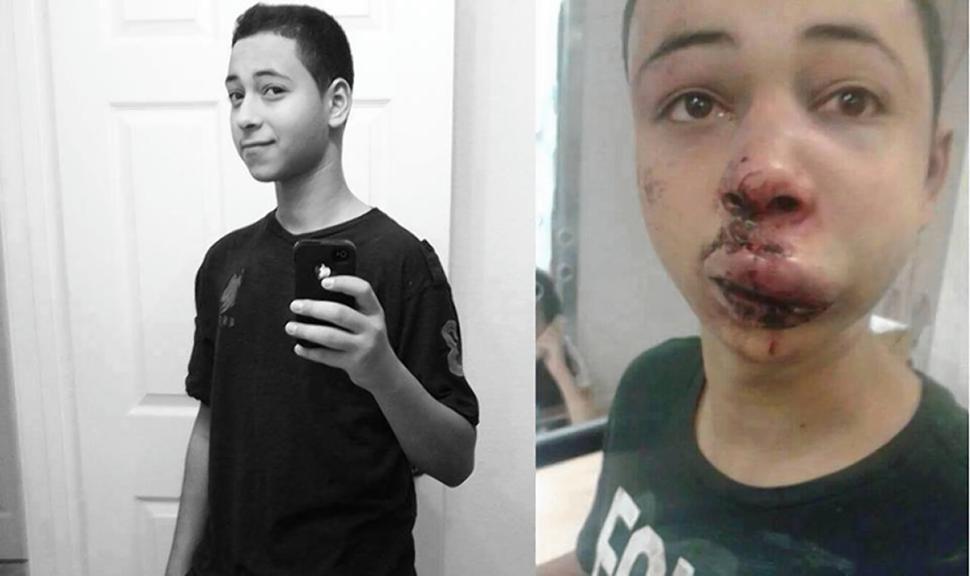 Motionless Palestinian-American Teen Severely Beaten by Israeli Police
