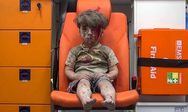 Russia Denies Its Strikes Hit Syrian Boy in Photo