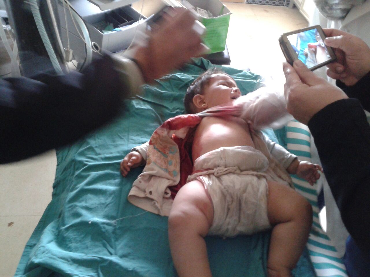 Syrian Baby Injured from Sniper Fire in Foua