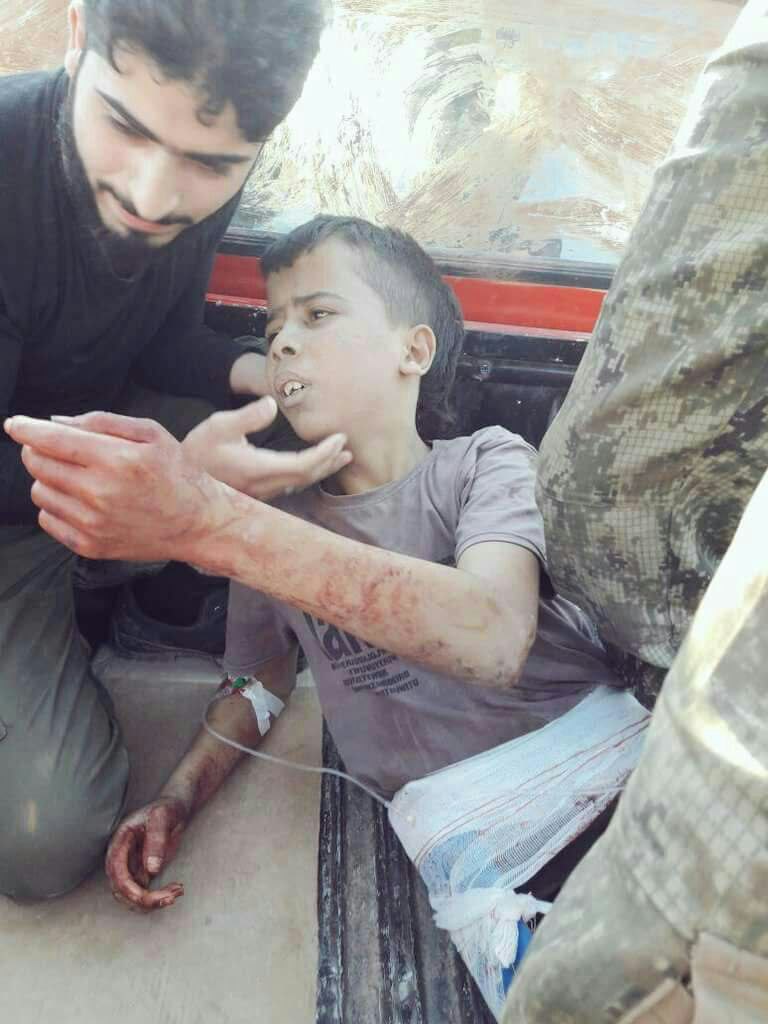 Aleppo: Takfiri Militants Slaughter Child in Handarat Camp