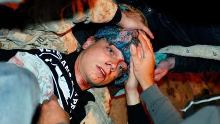 Injured US Protester to Undergo Brain Surgery
