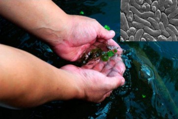 Vibrio vulnificus