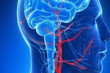 علماء يابانيون يكتشفون آلية لوقف نزيف المخ المميت