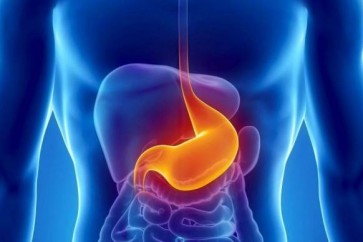 تصغير المعدة بلا جراحة.. طريقة مستمدة من التراث