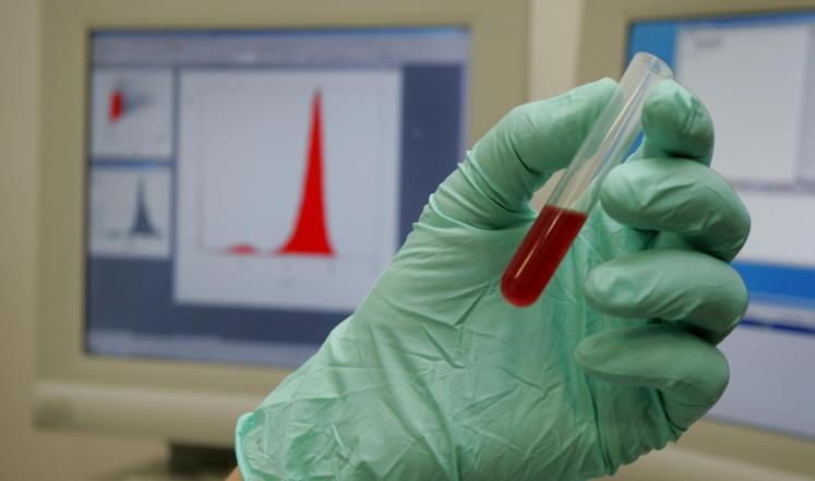 اختبار الدم مهم في التشخيص المبكر