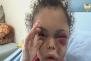 الطفلة بثينة اليمنية