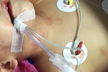 1504549329_IMG20170904WA00753