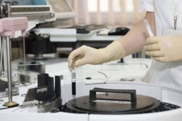 العلماء الروس يبتكرون كلية اصطناعية