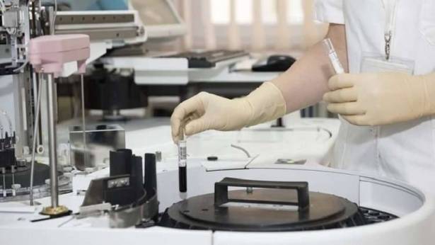 العلماء الروس يبتكرون كلية اصطناعية