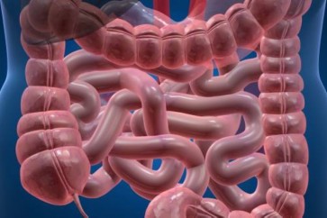 أسلوب الحياة غير الصحي ربما السبب في نصف حالات التهاب جدار القولون