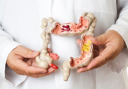 Large intestine