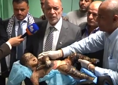 Gaza/le ministre égyptien de la santé devant un enfant tué par les raids israéliens