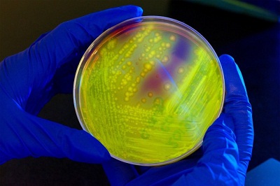 OMS: la résistance aux antibiotiques nous menace tous