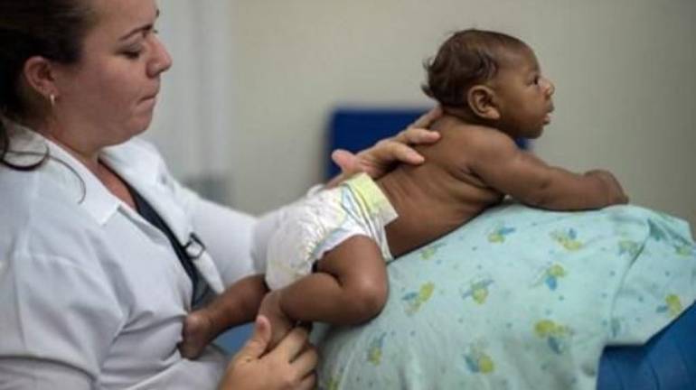 
Brésil: 404 cas de microcéphalie confirmés, 3.670 autres suspects
