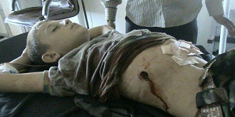 Grupos armados atacan escuela de Alepo con morteros: 4 muertos